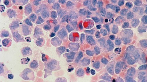 STUDIU Cercetătorii maghiari anunță că au dezvoltat un medicament împotriva cancerului / A vindecat complet șoarecii de laborator cu un singur tratament