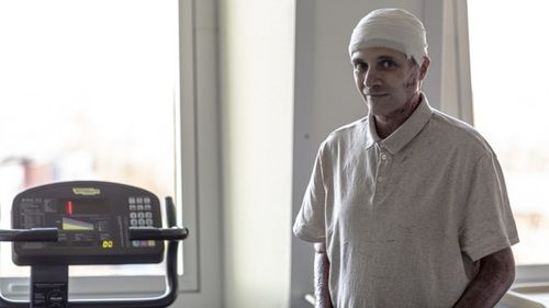 Imagini cu medicul Cătălin Denciu, ars grav în incendiul de la Piatra Neamț și tratat în Belgia / ”Astăzi pot deja să pedalez pe bicicletă”