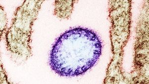 Organizația Mondială a Sănătății declară că riscul de răspândire a virusului Nipah în afara Indiei este redus / Virusul se transmite la oameni de la liliecii infectaţi sau de la fructele pe care aceştia le contaminează