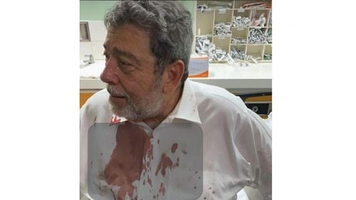 Premierul din Saint Vincent și Grenadine, lovit în cap cu o piatră în timpul unui protest anti-COVID. A fost internat în spital