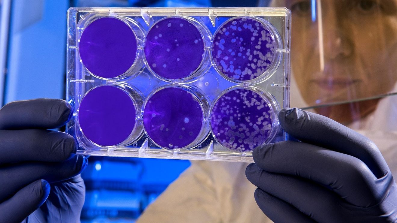 Ce este Escherichia coli (E. coli), bacteria cu două fețe? / Sfaturi pentru a nu vă infecta