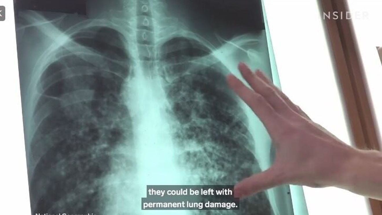 Aparat performant de analiză a testelor pentru Covid-19 adus la Iaşi, cu bani strânşi din donaţii. Se vor putea procesa 450 de teste pe zi, aparatul fiind montat la Spitalul de Boli Infecţioase