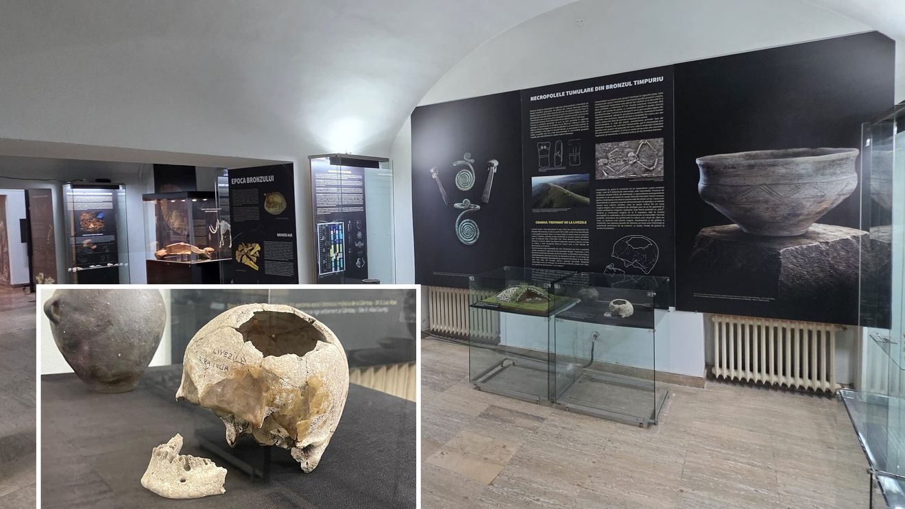 Operație reușită pe creier, veche de 4.500 de ani, în expoziția Muzeului Național al Unirii din Alba Iulia. Craniul trepanat de la Livezile, una dintre cele mai spectaculoase descoperiri preistorice din România. Ce arată studiile antropologice