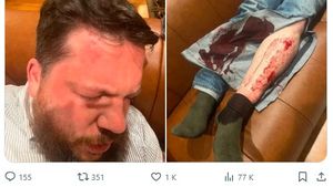 Un opozant rus apropiat de Navalnîi a fost atacat în faţa locuinţei din Vilnius / Leonid Volkov trăiește în exil în Lituania
