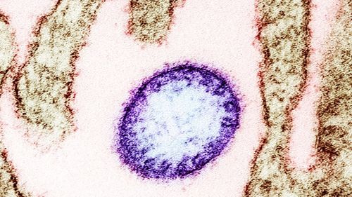 Organizația Mondială a Sănătății declară că riscul de răspândire a virusului Nipah în afara Indiei este redus / Virusul se transmite la oameni de la liliecii infectaţi sau de la fructele pe care aceştia le contaminează