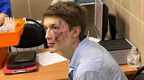 Un jurnalist rus critic la adresa regimului Putin a fost atacat la Moscova și rănit grav la cap