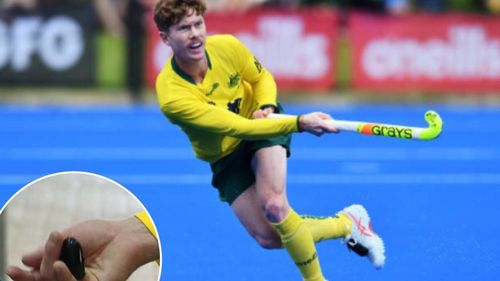 Un jucător australian de hochei pe iarbă şi-a amputat o parte din deget pentru a fi prezent la Paris
