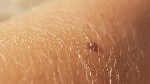 Oamenii de ştiinţă au dezvoltat o ”piele" electronică care se repară singură