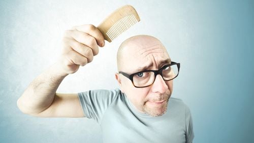 Bărbații cu chelie nu sunt, de fapt, lipsiți de păr. Cum susțin specialiștii că ar putea fi rezolvată problema care provoacă anxietate în cele mai multe dintre cazuri