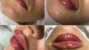 O cosmeticiană care se dădea drept medic estetician a fost prinsă de polițiști și acuzată de înșelăciune. Femeia va fi dusă la audieri