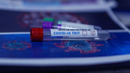 Oamenii de ştiinţă din Marea Britanie dezvoltă noi teste de anticorpi pentru a detecta variantele coronavirusului