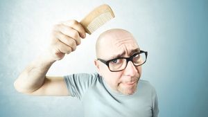 Bărbații cu chelie nu sunt, de fapt, lipsiți de păr. Cum susțin specialiștii că ar putea fi rezolvată problema care provoacă anxietate în cele mai multe dintre cazuri
