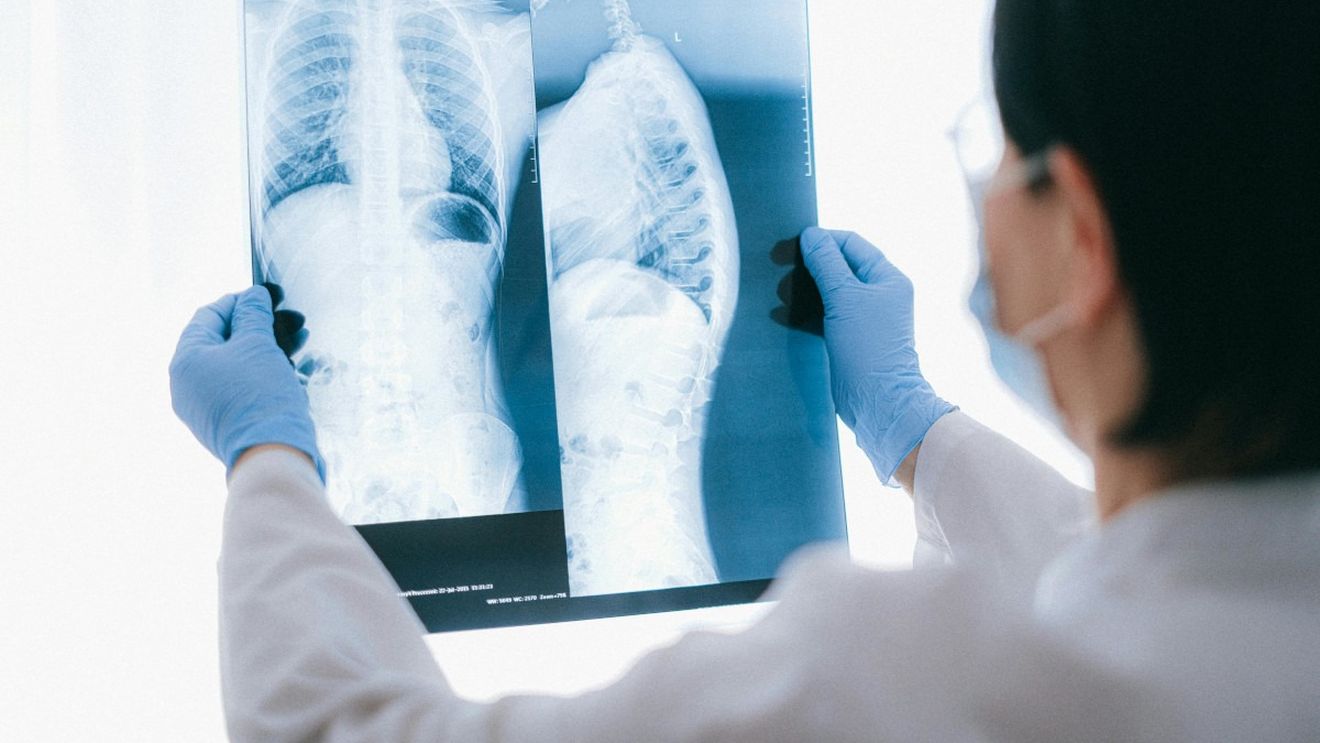 Comisia Europeană autorizează primul tratament pentru o boală pulmonară cronică gravă