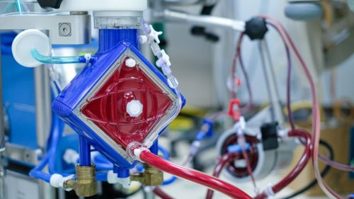 Un bărbat din Iași, găsit în hipotermie, a fost salvat printr-o tehnică ce este aplicată în doar două spitale din țară / A beneficiat de oxigenare extracorporeală cu membrană (ECMO) / Bărbatul avea 23°C și era fără activitate cardiacă, respiratorie și cerebrală