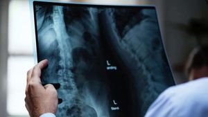 Radiografiile color de înaltă rezoluţie ar putea permite depistarea precoce a cancerului