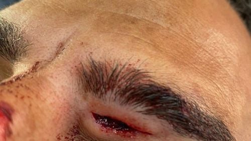 VIDEO Patru poliţişti italieni,  bătuţi crunt de un român / Ei dau vina pe sistem, care nu le permite să folosească armele din dotare