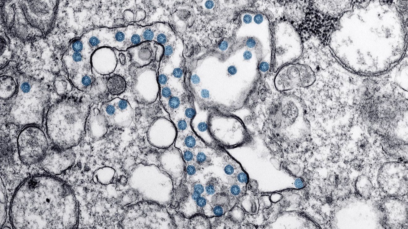 Cercetători spanioli au creat un nanomaterial care elimină coronavirusul şi ar putea fi utilizat la măştile sanitare