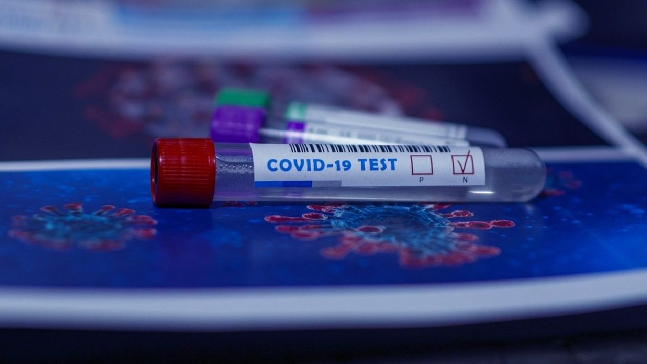 Oamenii de ştiinţă din Marea Britanie dezvoltă noi teste de anticorpi pentru a detecta variantele coronavirusului