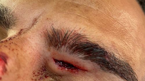 VIDEO Patru poliţişti italieni,  bătuţi crunt de un român / Ei dau vina pe sistem, care nu le permite să folosească armele din dotare