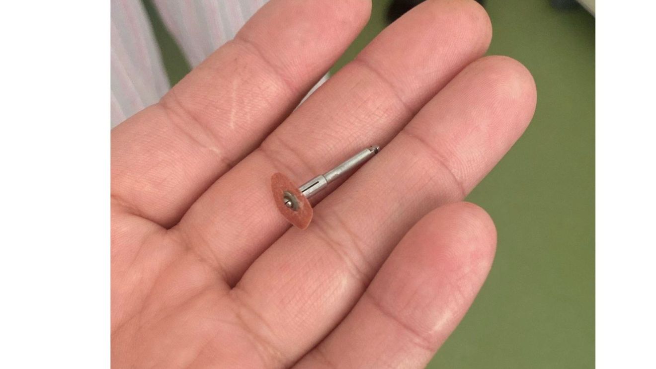 Un dentist din Iași a scăpat în gura unui copil de 5 ani un dispozitiv metalic, iar acesta l-a înghițit / „Ce vă agitați, n-a murit!” / Au dat în judecată clinica, solicitând despăgubiri în valoare de 15.000 de euro