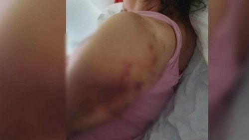 O femeie din Mureș, dusă la spital cu gripă, are acum fracturi la umeri și nu-și poate mișca brațele