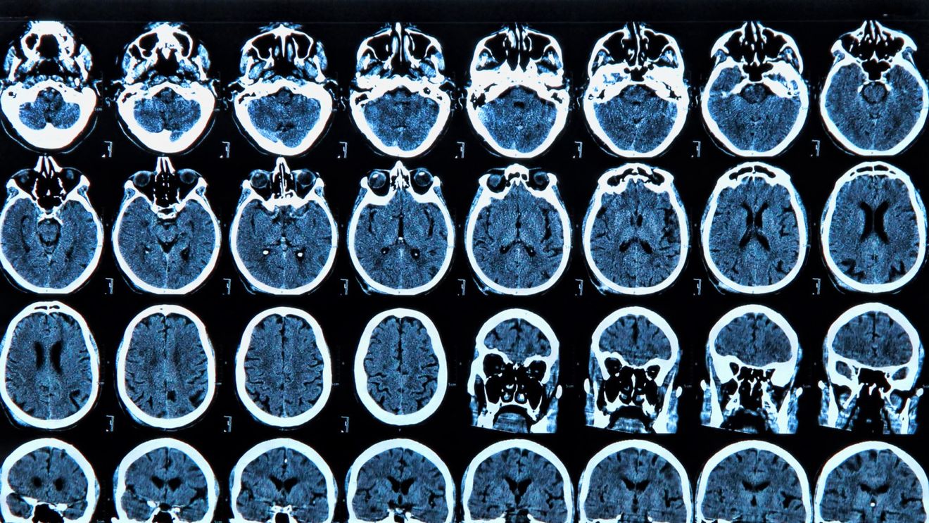 Un nou studiu asociază deteriorarea rețelelor cerebrale cu creșterea fundamentalismului religios