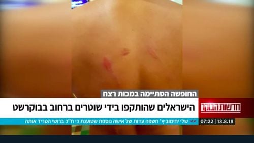 VIDEO ”Vacanță încheiată cu o bătaie soră cu moartea: Efectiv ne-au linșat” - povestea unor turiști israelieni dați jos din taxi de jandarmi și bătuți crunt vineri seară / Ambasada Israelului: Considerăm acest incident ca fiind inacceptabil și extrem de serios