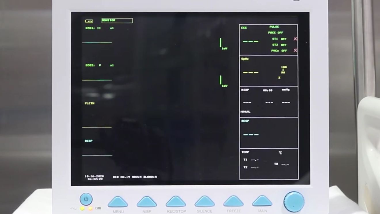Dispozitivele medicale chinezeşti, inclusiv monitorul popular Contec CMS8000, sub atenţia autorităţilor americane din cauza riscurilor cibernetice