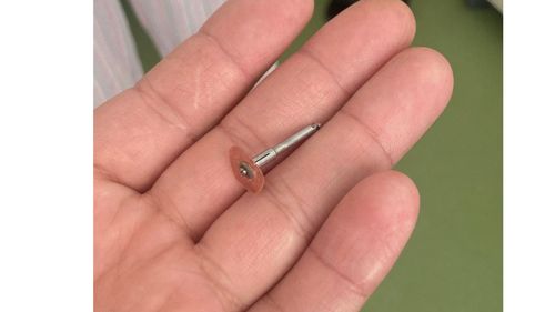 Un dentist din Iași a scăpat în gura unui copil de 5 ani un dispozitiv metalic, iar acesta l-a înghițit / „Ce vă agitați, n-a murit!” / Au dat în judecată clinica, solicitând despăgubiri în valoare de 15.000 de euro