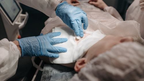 Autorităţile din California anunţă un caz de ciumă / Anual se înregistrează circa 7 cazuri de ciumă la om în Statele Unite