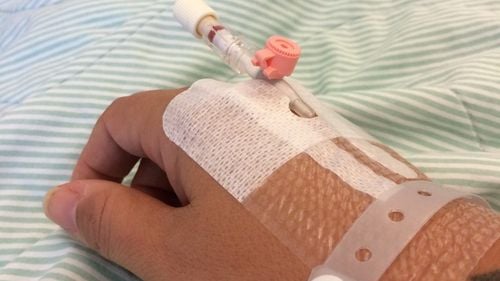 Cele două fete din Cluj care au suferit arsuri în urma unui experiment, la un atelier de chimie, nu ar fi păstrat distanţa recomandată şi au căzut peste masă, au stabilit polițiștii