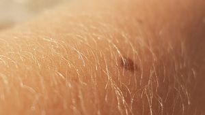 Oamenii de ştiinţă au dezvoltat o ”piele" electronică care se repară singură