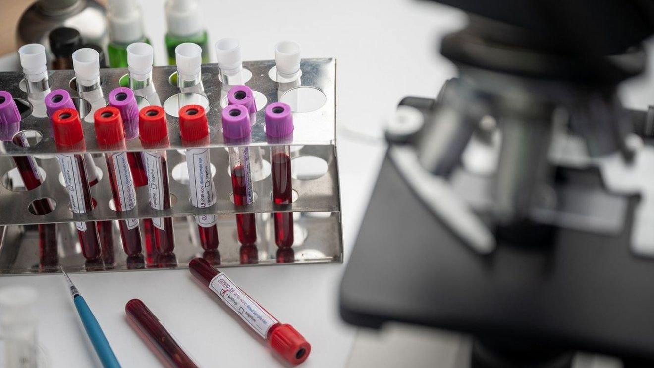 Un simplu test de sânge ar putea detecta cu precizie cancerul ovarian în stadii incipiente