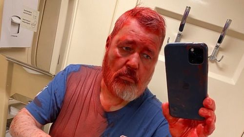 Redactorul-șef al Novaya Gazeta și laureatul Premiului Nobel pentru Pace, Dmitri Muratov, stropit cu vopsea într-o gară din Moscova