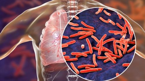Studiu: Simplul act de a respira poate fi un mod major de transmitere a tuberculozei