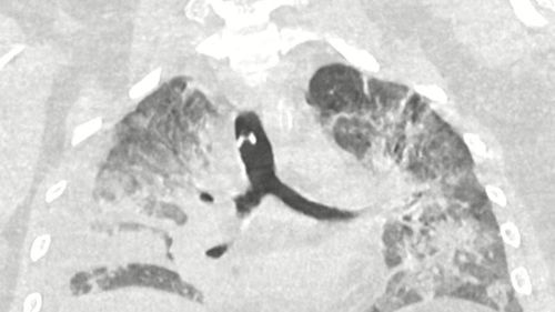 Centrul de recuperare a bolnavilor cu boli pulmonare sau cu sechele post-COVID va fi gata în primăvară / Primar: ”Am învestit anul acesta aproape 50 de milioane de lei în infrastructura de sănătate a Timişoarei”