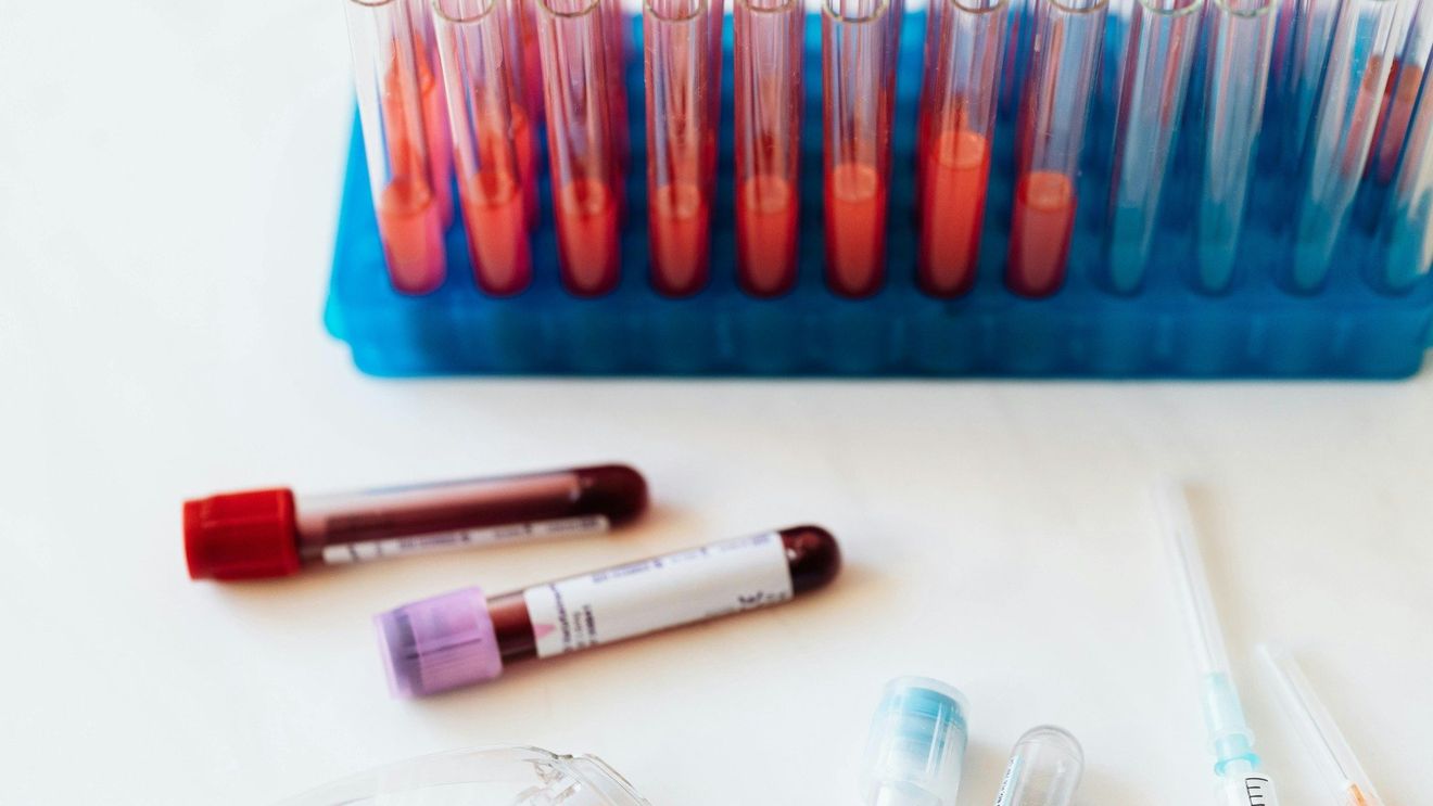 Un test de sânge ar putea detecta boala cu 10 ani înainte de apariţia simptomelor, potrivit unui studiu