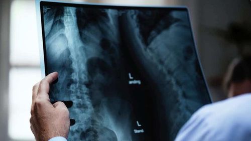 Un sfert dintre pacienţii care şi-au făcut bronhoscopii la Spitalul Județean Arad au fost diagnosticaţi cu neoplasm pulmonar / Simptome: dureri în piept, respiraţie greoaie, tuse prelungită, infecţii pulmonare dese