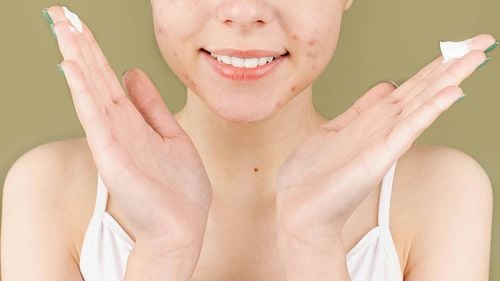 Benzen, o substanţă cancerigenă, a fost descoperit în unele produse populare folosite împotriva acneei