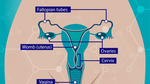 O metodă de a contracara rezistența la chimioterapie în cancerul ovarian, descoperită de cercetători de la Imperial College London