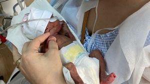 Ziua Mondială a Prematurității: Cel mai mic dintre bebeluşii născuți în 2022 la Spitalul Universitar din București a cântărit sub 500 de grame