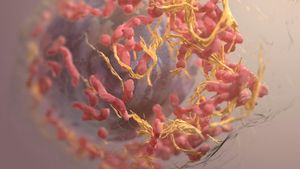 Bacteria comună care cauzează cele mai multe cazuri de cancer la nivel mondial