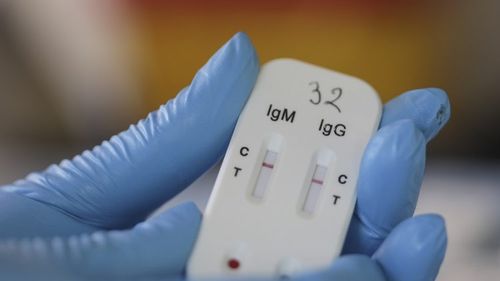 Farmaciile din Franța au fost autorizate să facă teste serologice rapide pentru detectarea anticorpilor la noul coronavirus