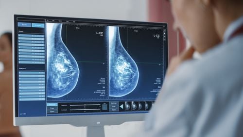 MedLife își consolidează poziția pe segmentul de oncologie printr-un nou parteneriat cu Institutul Sânului, extinzând serviciile dedicate tratamentului cancerului mamar