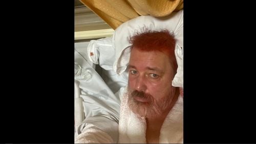 Redactorul-șef al Novaya Gazeta, laureat al Premiului Nobel pentru Pace, Dmitri Muratov, diagnosticat cu arsuri la nivelul ochilor și conjunctivită, după ce a fost atacat joi într-un tren din Moscova