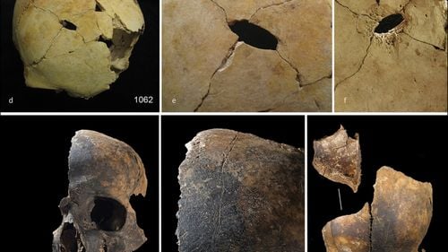 „Ceva oribil": Oasele găsite într-o groapă din Somerset dezvăluie un episod brutal de canibalism din epoca bronzului în Marea Britanie