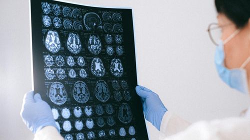 Un neurolog a spus ce mănâncă aproape zilnic la prânz pentru a preveni apariția bolii Alzheimer