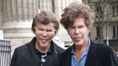 VIDEO Cei mai faimoși gemeni din Franța au murit la șase zile distanță