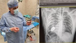Ucraina: Medicii militari au scos o grenadă neexplodată din corpul unui soldat