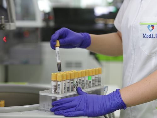 Noua generație de screening prenatal: un simplu test de sânge poate detecta riscul unor anomalii genetice încă din primul trimestru de sarcină